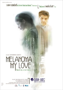 Melanoma ahuvati Trailer