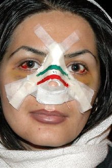 Nose Iranian Style Trailer