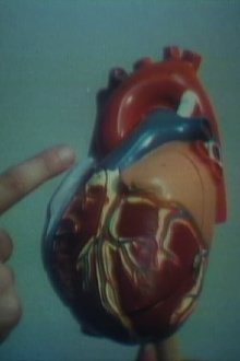 Open Heart Surgery Trailer