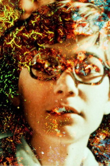 Pigment-Dispersion Syndrome Trailer