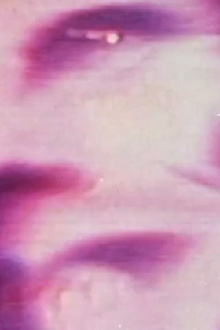 Plastic Surgery Trailer
