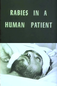 Rabies in a Human Patient Trailer