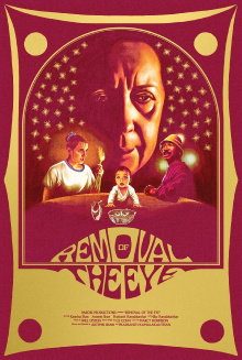 Removal of the Eye Trailer
