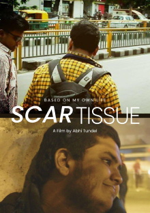 Scar Tissue Trailer