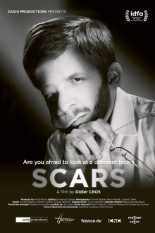 Scars Trailer