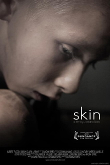 Skin Trailer