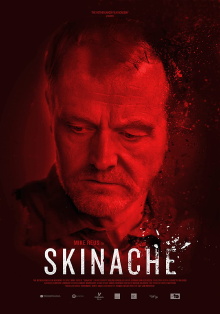 Skinache Trailer