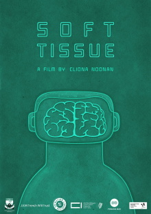 Soft Tissue Trailer