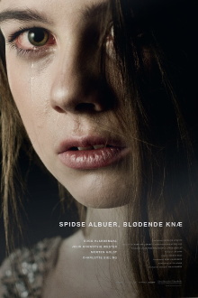 Spidse albuer, blødende knæ Trailer