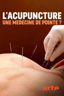Spitzenmedizin: Akupunktur - Mythos oder Therapie? Trailer