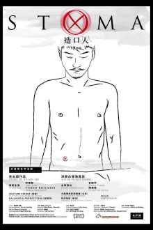 Stoma Trailer