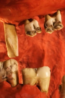 Teeth Bath Trailer