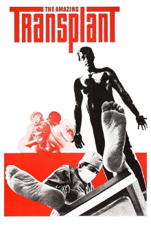 The Amazing Transplant Trailer
