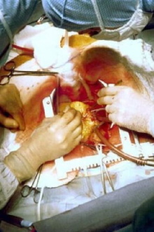 "The Heart" 40 Years Later Trailer