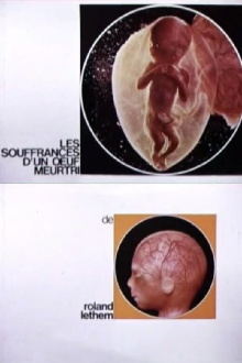 The Sufferings of a Wounded Egg Trailer