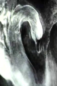 The Swan Trailer