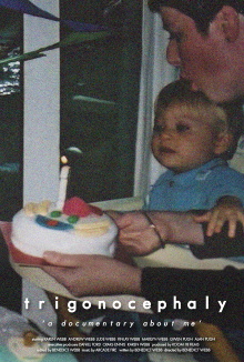 Trigonocephaly: A Documentary About Me Trailer