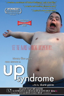 Up Syndrome Trailer