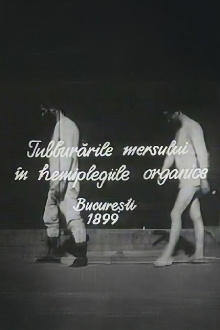 Walking Troubles of Organic Hemiplegy Trailer