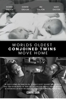 World's Oldest Conjoined Twins Move Home Trailer