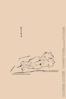 Wound Trailer