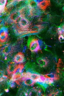 Wound Trailer