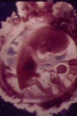 Le ventre, un supermonde (1974)