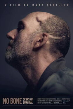 No Bone: Scars of Survival (2020)