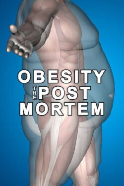 Obesity: The Post Mortem (2016)