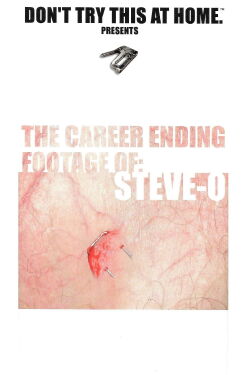 The Career Ending Footage of: Steve-O (2001)