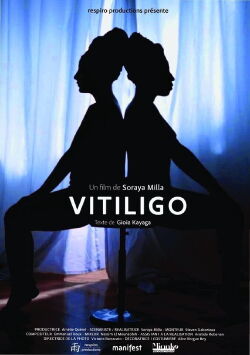 Vitiligo (2019)