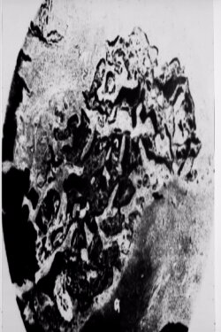 A Negative (1977)