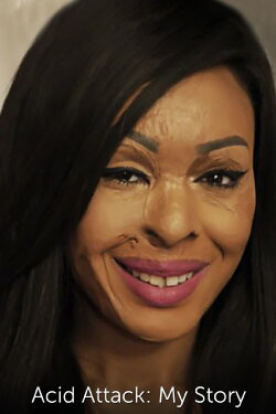 Acid Attack: My Story (2018) Acid Attack: My Story (2018)