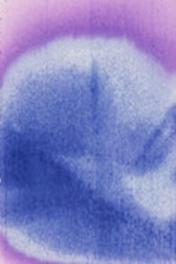 Acidfilmda (1992) Acidfilmda (1992)
