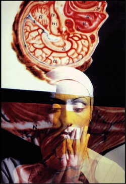 Arteria magna in dolore laterali (1979) Arteria magna in dolore laterali (1979)
