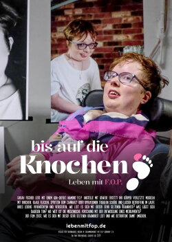 Bis auf die Knochen - Leben mit FOP (2024) Bis auf die Knochen - Leben mit FOP (2024)