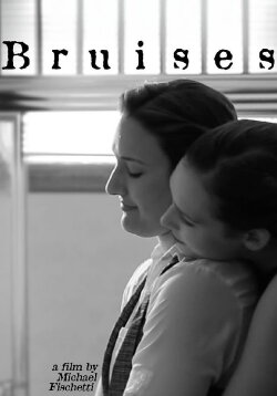 Bruises (2018)