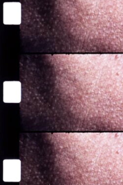 Carotid Artery (1970) Carotid Artery (1970)