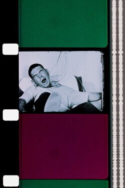 Epileptic Seizure Comparison (1976) Epileptic Seizure Comparison (1976)