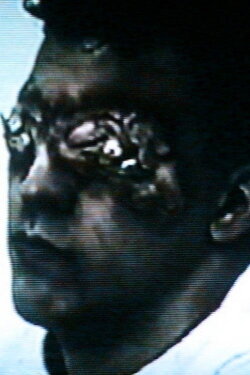 Esophagus (2004) Esophagus (2004)