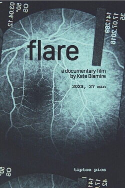 Flare (2024)