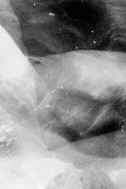 Gewebe (1976)
