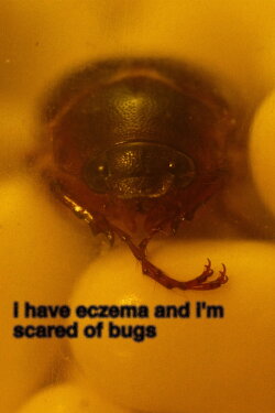 i have eczema and i'm scared of bugs (2024) i have eczema and i'm scared of bugs (2024)