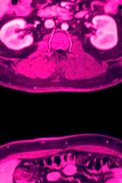in ocula oculorum (2022) in ocula oculorum (2022)