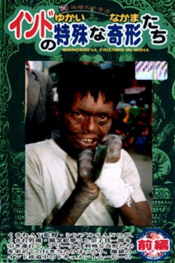 India's Unique Deformed Creatures (The Curious Companions) Part 1 (1999) India's Unique Deformed Creatures (The Curious Companions) Part 1 (1999)