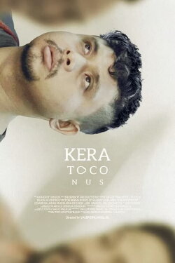Keratoconus (2021) Keratoconus (2021)