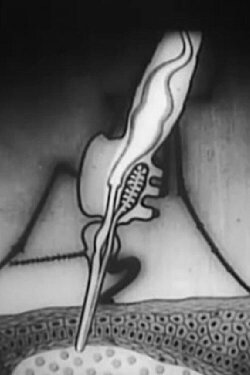 Malaria (1933)
