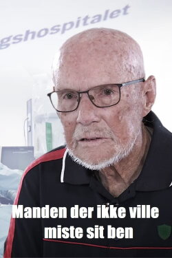 Manden der ikke ville miste sit ben (2022) Manden der ikke ville miste sit ben (2022)
