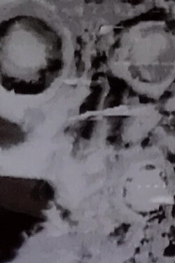 Minus 1 (1969) Minus 1 (1969)