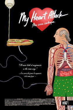 My Heart Attack (2015)